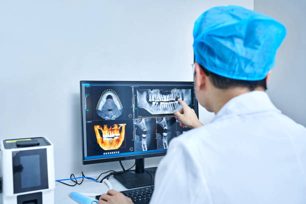 Best Emergency Tooth Extraction in Murillo, TX